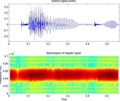 Figure 10. Audio signal (above) and spectrogram of the Doppler signal (below) for the word canto