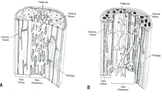Figura 3 – Distinção entre o Osso Normal e o Osso Osteoporótico 
