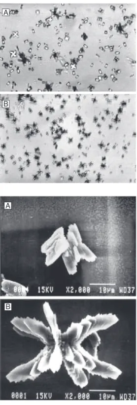 Figure 4. Effects of uromodulin from normal men (A) and stone formers (B) on calcium oxalate crystallization (light microscopy, 500X).
