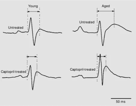 Figure 1. ECG tracings of representative rats of each experimental group. The arrow s indicate the length of the QT interval