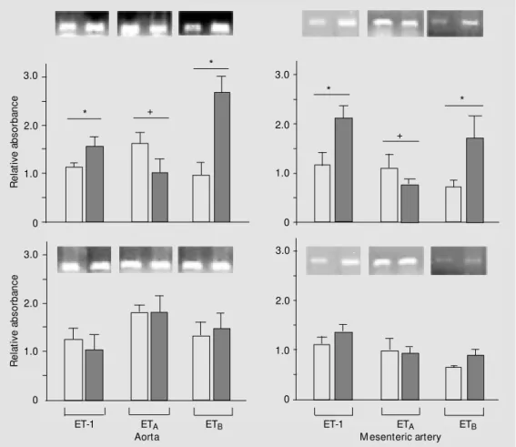 Figure 3. Representative RT-PCR products of 20 ng total RNA extracted from aortas and  mes-enteric arteries of male (top) and female (bottom) control (open columns) and DOCA-salt (filled columns) rats