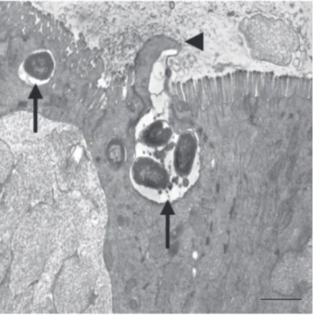 Figure 1. Transmission electron micrograph showing invasion of bovine enterocytes in the Peyer’s patches by Salmonella typhimurium