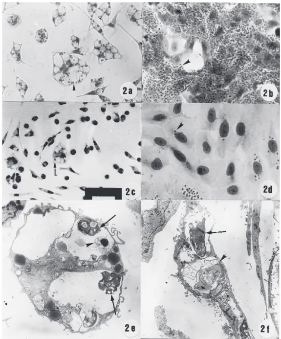 Figure 2. Effect of hydroxyurea on the intracellular multiplication of T. gondii, L. amazonensis and T