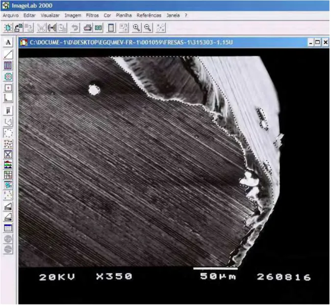 Figura 12 – Quantificação das deformações das fresas no software Imagelab 2000  através da ferramenta selecionar região