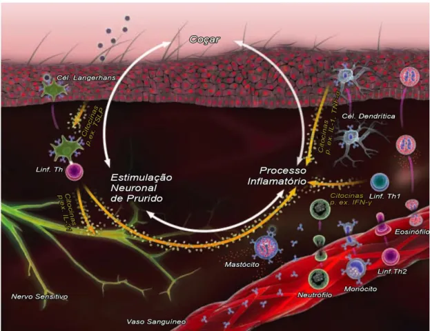 Figura 3. Esquema ilustrativo da progressão da patofisiologia na DAC. Após exposição subsequente ao mesmo  alérgeno, as células de Langerhans da epiderme, que possuem IgE alergeno-específica na sua superfície,  ligam-se  de  forma  eficiente  ao  alérgeno 