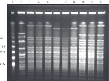 Figure 1. PFGE of Enterococcus faecalis.  Lane 1, Molecular weight lambda ladder size marker (kb); lane 2, E