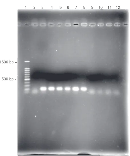 Figure 3. Demonstration of transposon Tn1546 in vancomycin-resistant isolates of Entero- Entero-coccus faecalis by PCR