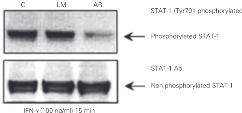 Figure 4. Evaluation of signal transducer and activator of transcription 1 (STAT-1) phosphory- phosphory-lation in response to interferon-gamma (IFN-γ) in EBV-B cells from two patients and one healthy control (C)