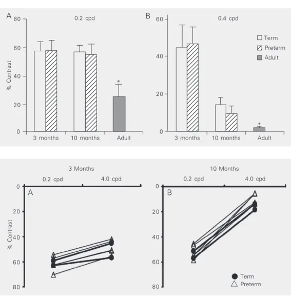 Figure 2. The development of contrast sensitivity thresholds for low and middle spatial  fre-quencies at 3 months (A) and 10 months (B) in term and preterm infants