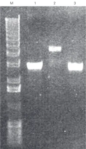 Figure 1. Plasmid yield from cul- cul-tures of Escherichia coli  trans-formed with pRSETA, pET-His or pAE plasmid