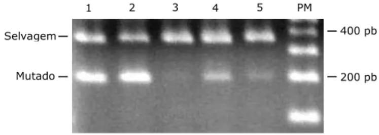 Figura 2 : Detecção da V617F-JAK2 por AS-PCR  Linha  1  –  controle  positivo  para  a  V617F