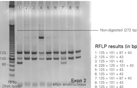 Figure 1. Restriction fragment length polymorphism (RFLP) banding patterns of HLA-A exon 2 digested with endonuclease MspI (lanes 1-9)