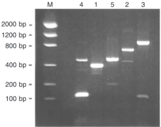 Figure 2. Agarose gel (2%) elec- elec-trophoresis of PCR products.