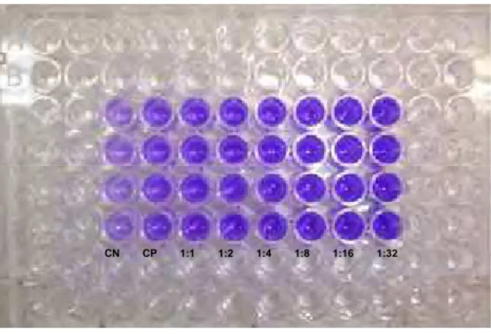FIGURA 7 – Placa de 96 poços com células coradas pelo corante cristal violeta  (CN –controle negativo; CP – controle positivo).