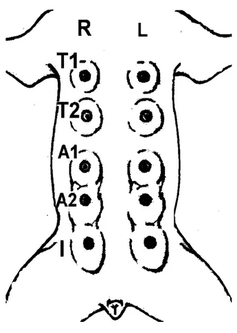 Figura 1 – Representação esquemática dos cinco pares de mama canina e suas  denominações