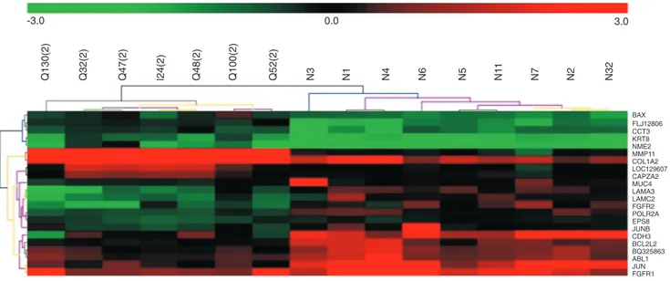 Figure 1. Unsupervised hierarchical clustering of 7 clinical stage II breast cancer samples and 9 normal breast samples (N) based on 22 differentially expressed genes at a false discovery ratio level of 0.05