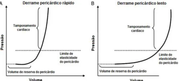 Figura  3:  Alterações  Hemodinâmicas  num cão após tamponamento cardíaco  experimental (adaptado de Leimbruger  et  al.,  1983)
