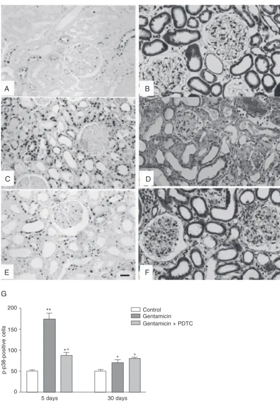 Figure 1. Immunolocalization of p-p38 MAPK in the renal cortex (A, C and E) and in Masson’s trichrome-stained histological sections (B, D and F) from rats killed 5 days after treatment with NaCl (A and B), gentamicin (C and D) or gentamicin + PDTC (E and F