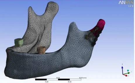 Figura 4 - Modelo da mandíbula e de placas no formato  CAD, pronto para análise de MEF