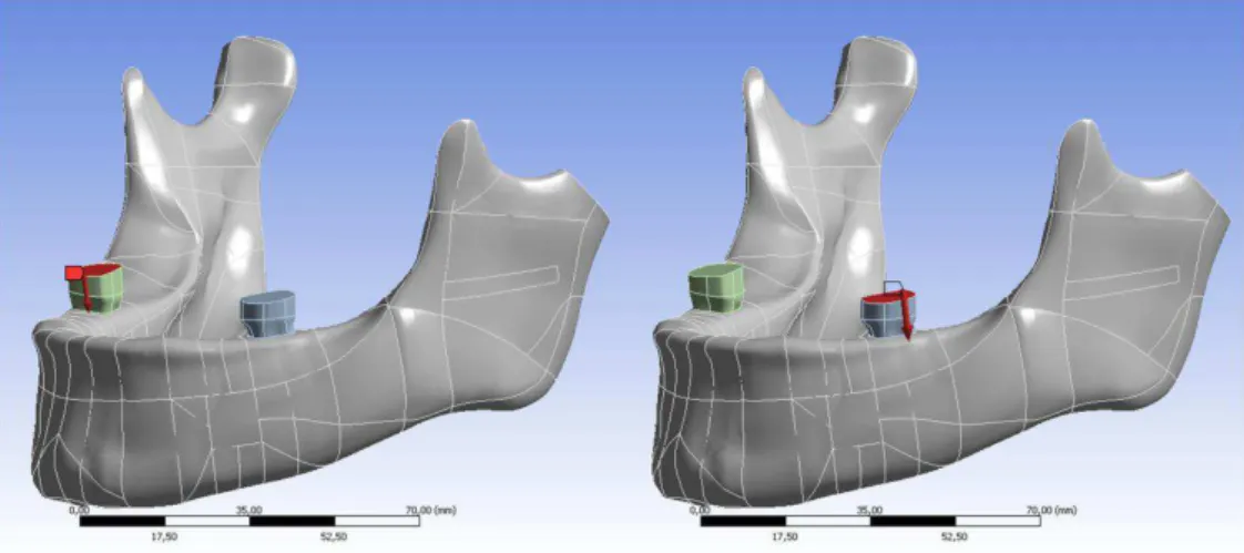 Figura  5  -  Modelos  mandibulares  evidenciando  a  localização  e  direção da força que foi aplicada no primeiro molar inferior de cada  lado