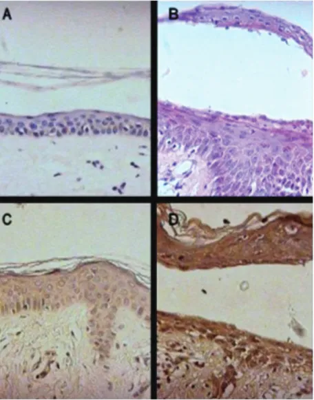 Figure 2. Representative light micrographs of immunohistochemistry for the detection of iNOS in a skin biopsy from healthy controls and pemphigus patients