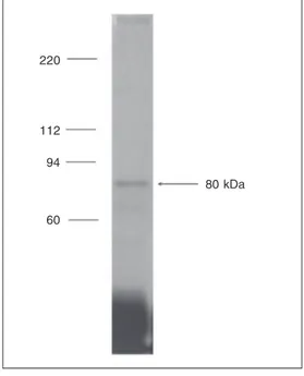 Figure 3 shows a representative labeling pattern of transferrin antigenicity in a CTOB cell