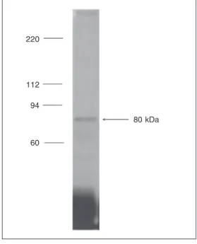 Figure 3 shows a representative labeling pattern of transferrin antigenicity in a CTOB cell