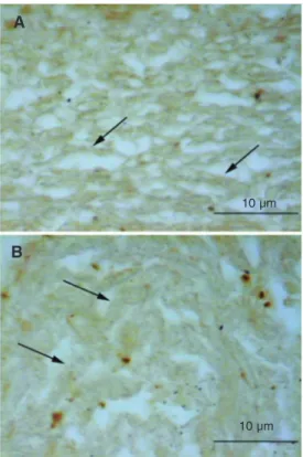 Figure 4. Tissue distribution of transferring on 6-µm paraffin sections. Immunolabeling of the intact (in situ) bovine trabecular meshwork (A) and cultured  tra-becular meshwork explant (B).