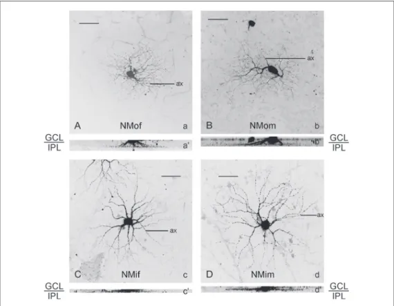 Figure 7. Laser scan microscop- microscop-ic projection images of examples of cells with thin dendrites (<1.8 µm)
