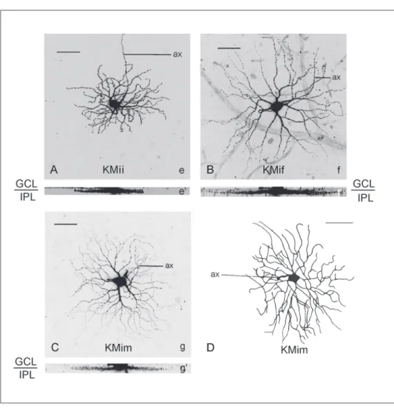 Figure 8. Laser scan microscop- microscop-ic projection images (A, B, C) and ink drawing (D) of examples of cells with thick dendrites (>1.8 µm)