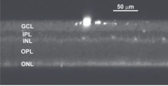 Figure 1. Optical section through a whole mount retina showing its different layers and one dendritic branch of a cell, filled with Lucifer yellow