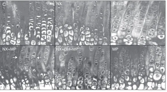 Figure 1. Histological sections of proximal tibial growth plates viewed by light microscopy from sham-operated rats (C) pair-fed with nephrectomized animals (NX) treated with recombinant human growth hormone (rhGH) (NX + GH), rhGH and  methyl-prednisolone 