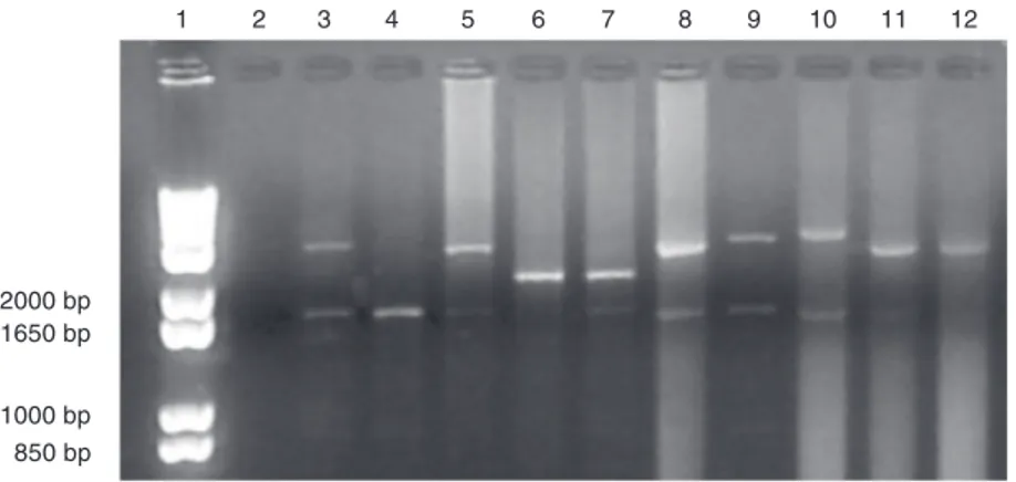 Figure 1. Amplified MUC-1 polymorphic fragments on 1.2% agarose gel. Lane 1, 1-kb DNA ladder; lane 2, negative control; lanes 3-7, control patients; lanes 8-12, infertile patients.