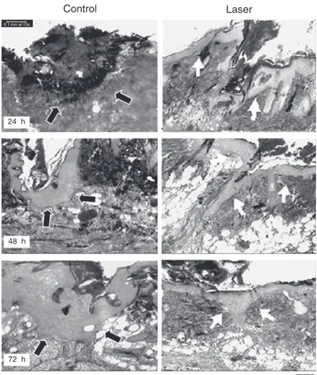 Figure 1. Photomicrograph of the skin wound of control (left, black arrows) and laser therapy (right, white arrows) groups at 24, 48, and 72 h