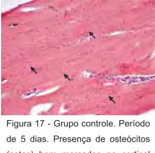 Figura 18 - Grupo tratado. Período  de 15 dias. Presença de osteócitos  (setas) bem marcados na cortical  inferior (HE, original de 200X)
