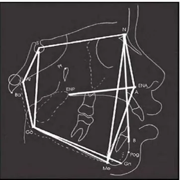 Figura 4. Pontos cefalométricos e medidas utilizadas no estudo. Comprimento maxila: ENP –  ENA; Comprimento mandíbula: Go – Gn; Altura facial : N – Me; Maxila x Base do crânio :  SNA; Mandíbula x Base do crânio: SNB