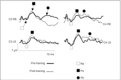 Table 3. Comparison of amplitude values (in µV) for the (C)APD group before and after training