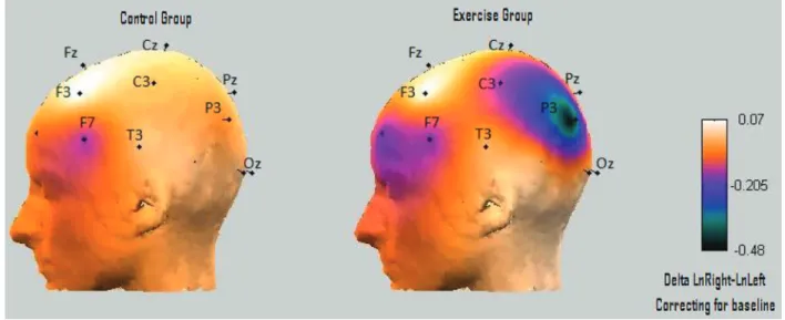 Figure  3.  Cortical  maps  of  asymmetry  values  for  control  (left)  and  exercising  (right)  subjects  with  major  depressive  disorder  after  treatment (corrected for baseline differences)