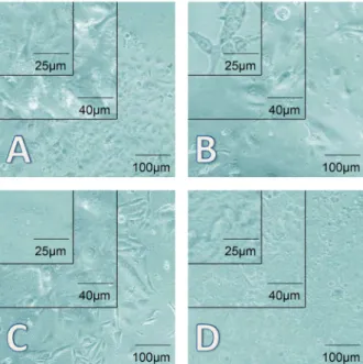 Figure 1. Non-proliferative epithelial cells in different stages. A,  Non-proliferative epithelial colonies consisted of islands of  con-densed epithelial cells after 48 h of culture