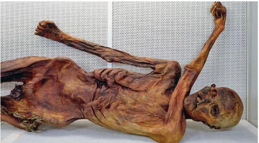 Fig. 6- Mummy of Ötzi the Iceman, a 3000-year-old naturally preserved mummy by the  dry, icy conditions of the Similaun mountain
