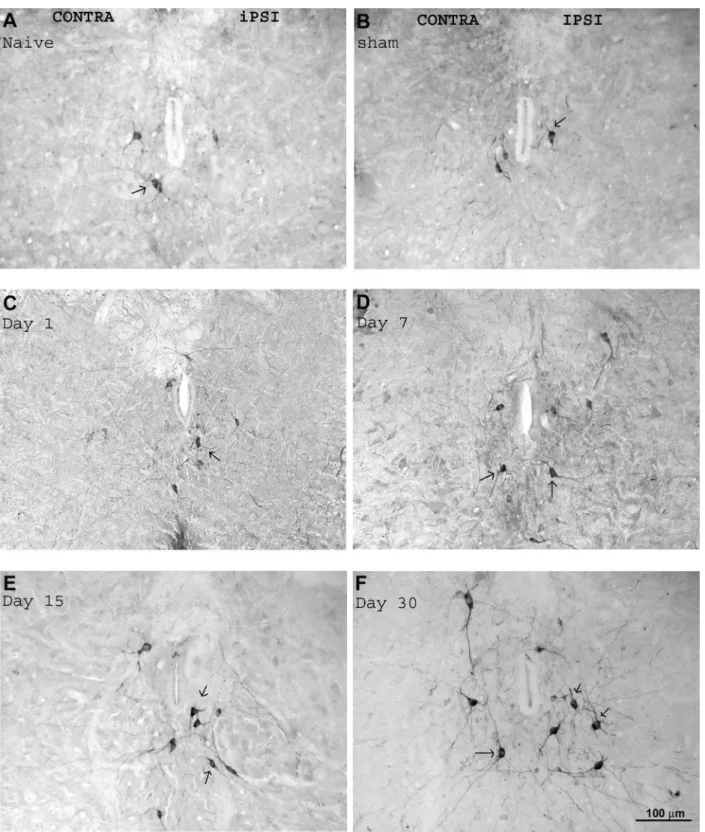 Figure 5. Digital images of neuronal nitric oxide synthase (nNOS) immunostaining around the central canal of the rat spinal cord after  transection of the sciatic nerve