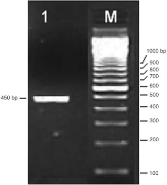 Figure 1. Reverse transcription polymerase chain reaction am- am-plification of mRNA encoding protein transcripts from lyophilized  venom