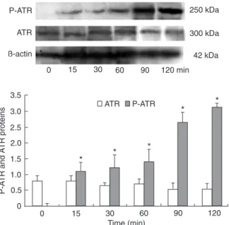 Figure  7.  Expression  of  Chk1  and  Chk2  in  BGC823  cells  by  immunoprecipitation  (IP)  and  Western  blotting