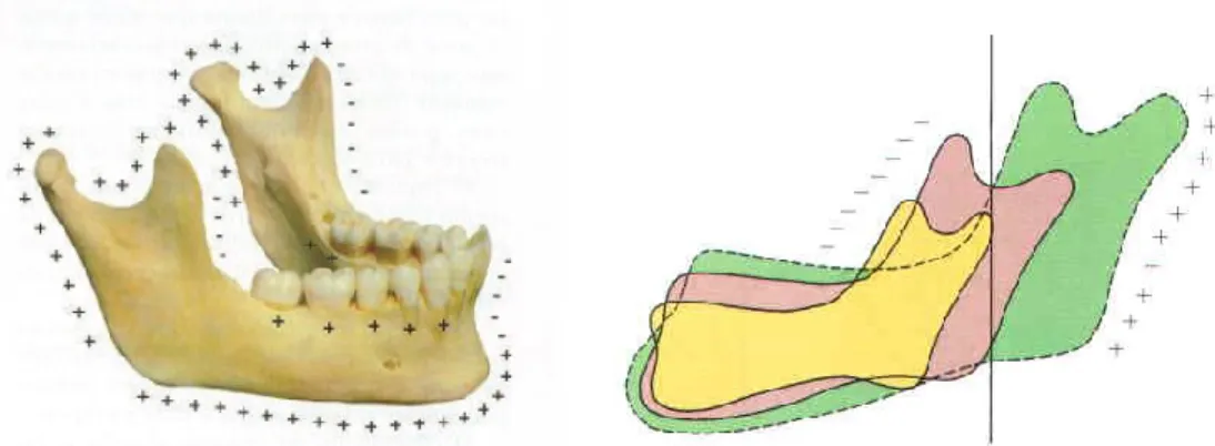 Figura 8 – Representação das áreas de reabsorção (-) e aposição (+) óssea na mandíbula (imagem  à direita)   (Ferreira, 2008)