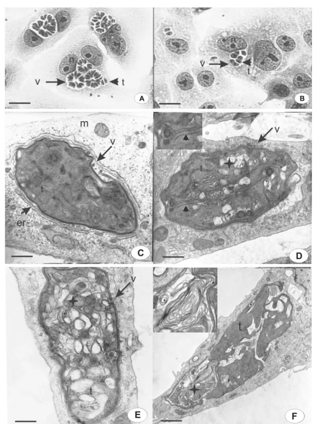 Figure 3. Morphological aspects of intravacuolar parasites observed by light microscopy (A,B) or transmission electron microscopy  (C-F)