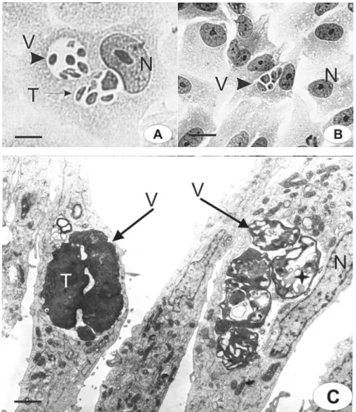 Figure 6. The reversible effects of compounds 1 and 4 were analyzed by light (A,B) or transmission electron microscopy (C)