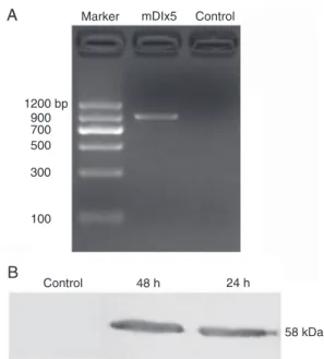 Figure  5.  Expression  of  GFP  and  NSE  in  ante- ante-rior  subventricular  zone  (SVZa)  neural   precur-sors  transfected  with  pEGFP-mDlx5