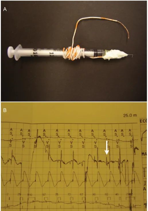 Figure 1. A , Modified injector with 90° bent tip, 5-mm injection depth, and copper lead for signal capture