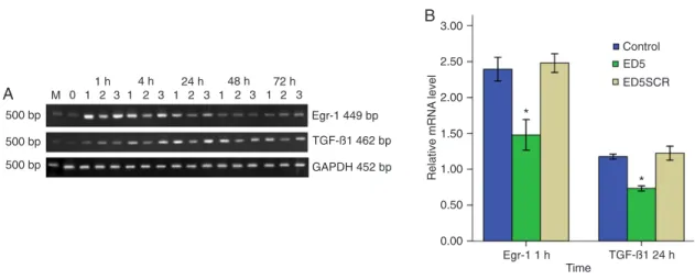 Figure 2.  Representative expression of Egr-1 and TGF-β1 mRNA in cultured vascular smooth muscle cells (VSMC) in each group