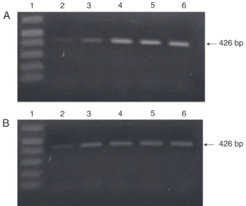 Figure 4. RT-PCR analysis of β2 integrin in embryonic chicken  hearts. RT-PCR analysis of β2 integrin subunit expression was  performed using total RNA isolated from whole embryonic  chick-en hearts (A) or dissected atriovchick-entricular canal regions (B)